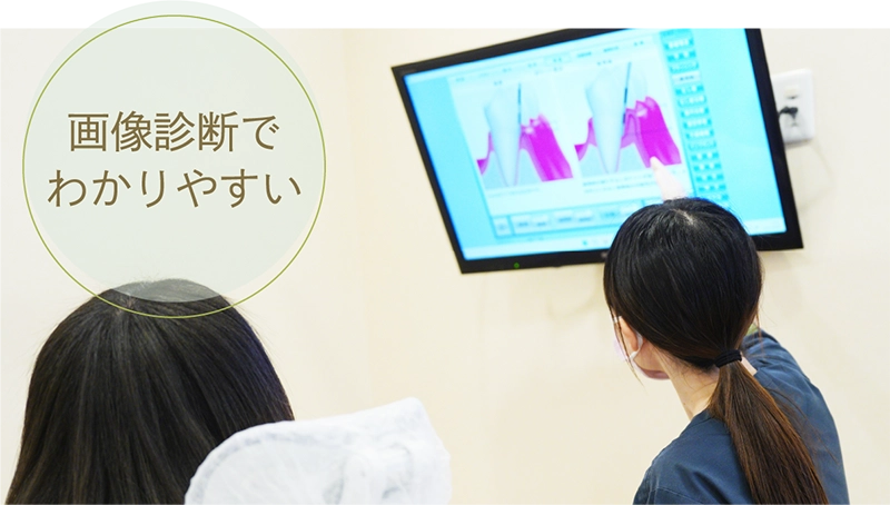 画像診断でわかりやすい
